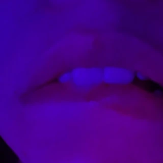 Veeee