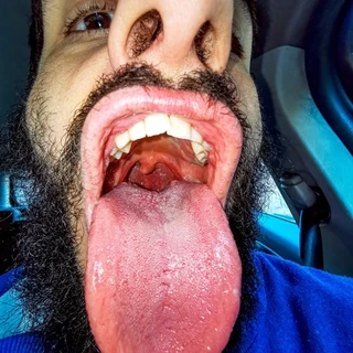 AlexanderVenom