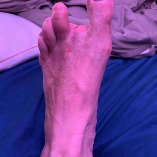 Andy’s strange foot