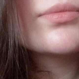🍒