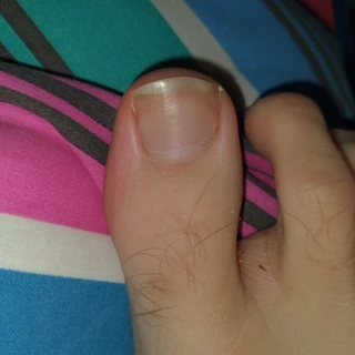 bertie toe