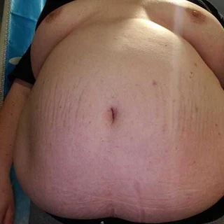 Chubchilensis