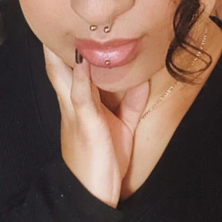 Aré