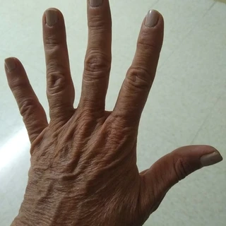 Dishpanmanhands