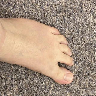 Drew’s Foot Crew
