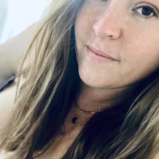 Freckles ✨
