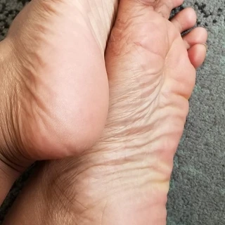Margoxt