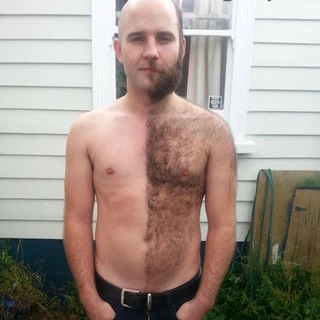 Hairy Navel