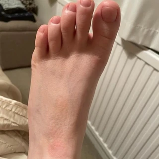 Bubble toes