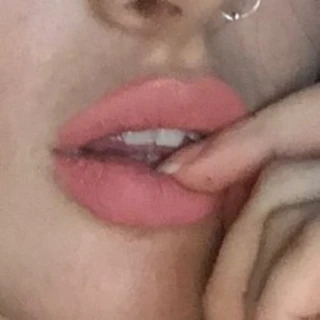 khole