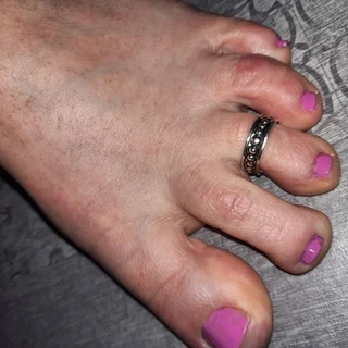 Lora Feet 💖