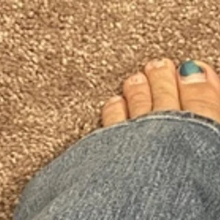 Rhi