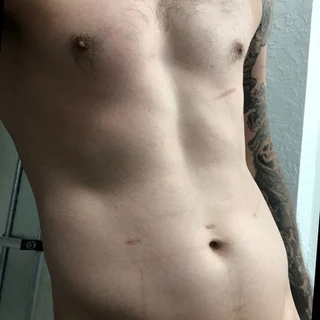 Bradlee