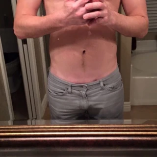MT