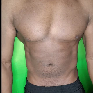 Muscle Phantom