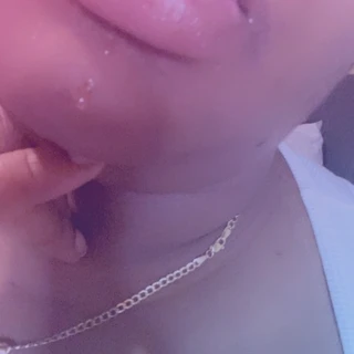 Naz