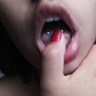 Rxs