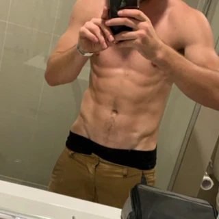 riley_bites