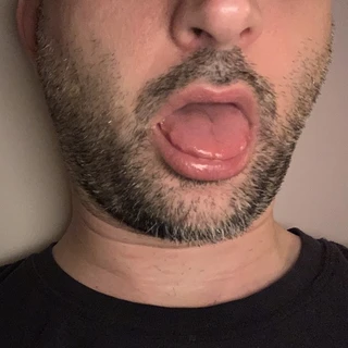 BiQtee69