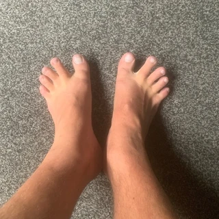 Robinsfeet
