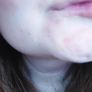 Shystrawberry 🍓