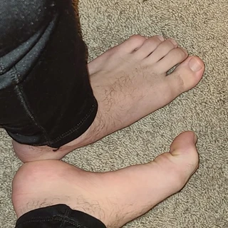 That One Foot Dude