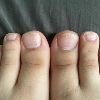 Feet!!!