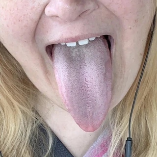 Talon TongueThroatLove