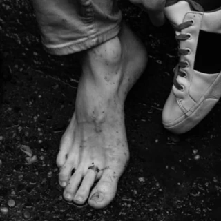 TooFeet
