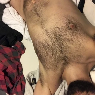 HairyVers420