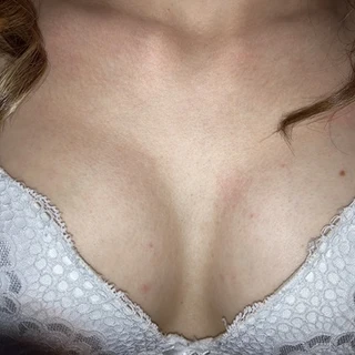 NoFaceCoupleXoXo