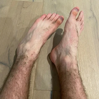 Mr. Hairy Feet & Legs