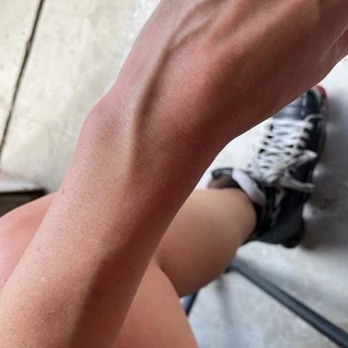 Vein Girl